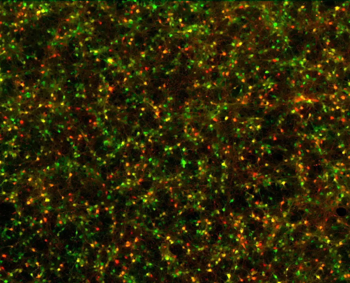 Neuronale Verbindungen visualisiert
